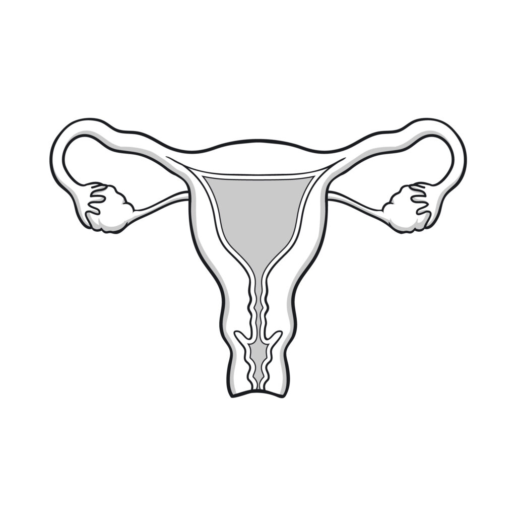 GyneFix (גיינפיקס) – התקן תוך רחמי גמיש, חדשני וללא הורמונים